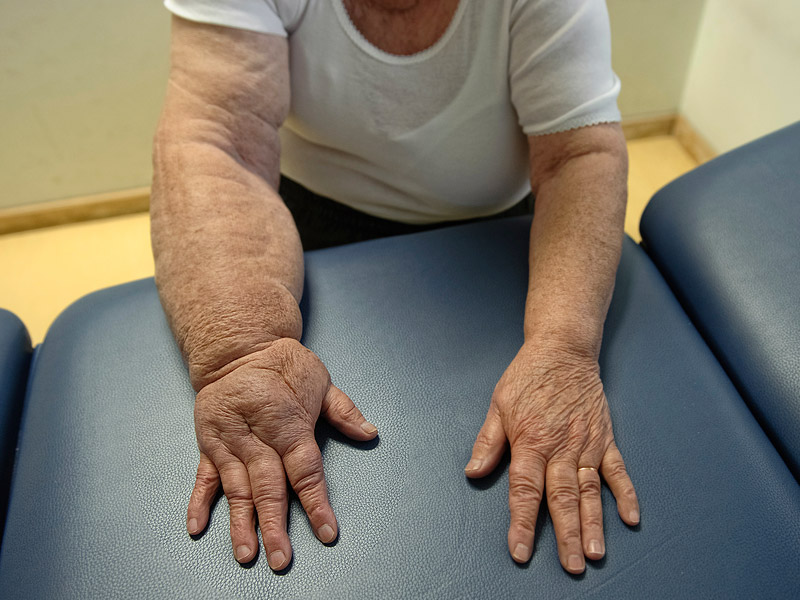 guvenli-eller-lenfodem